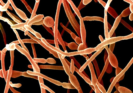 Image: Scanning electron micrograph (SEM) of Candida spp. (Photo courtesy of D. Phillips / Science Photo Library).